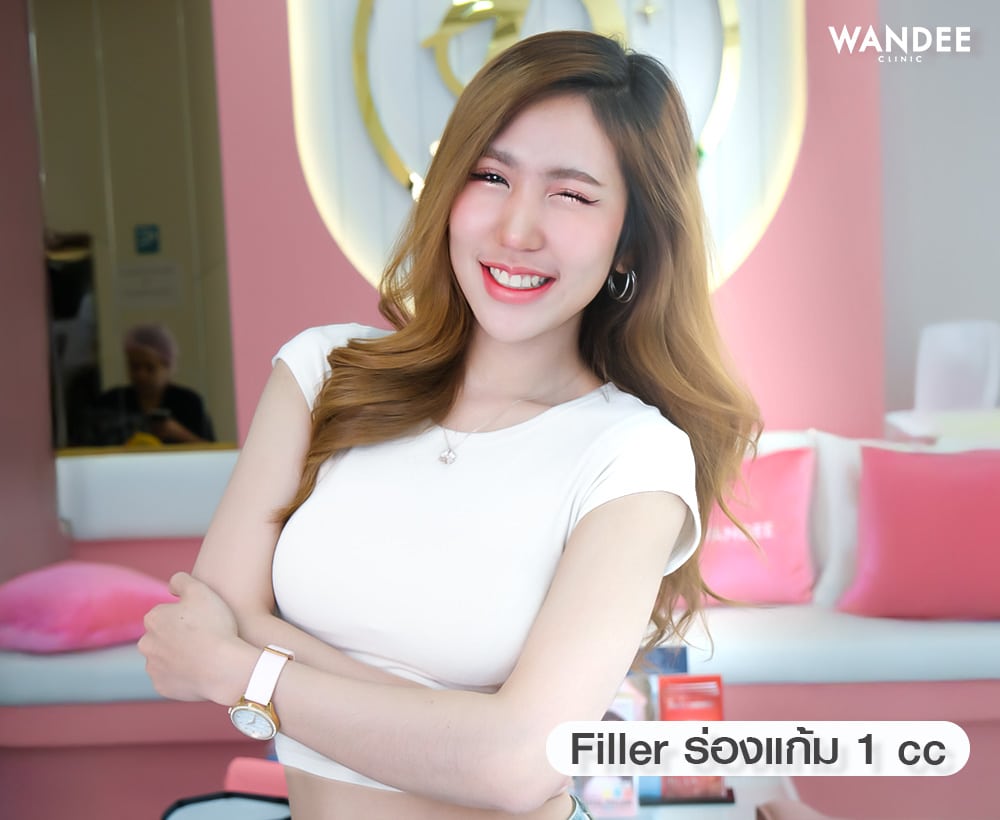 ฉีดฟิลเลอร์