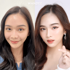 รีวิวฟิลเลอร์ร่องแก้ม