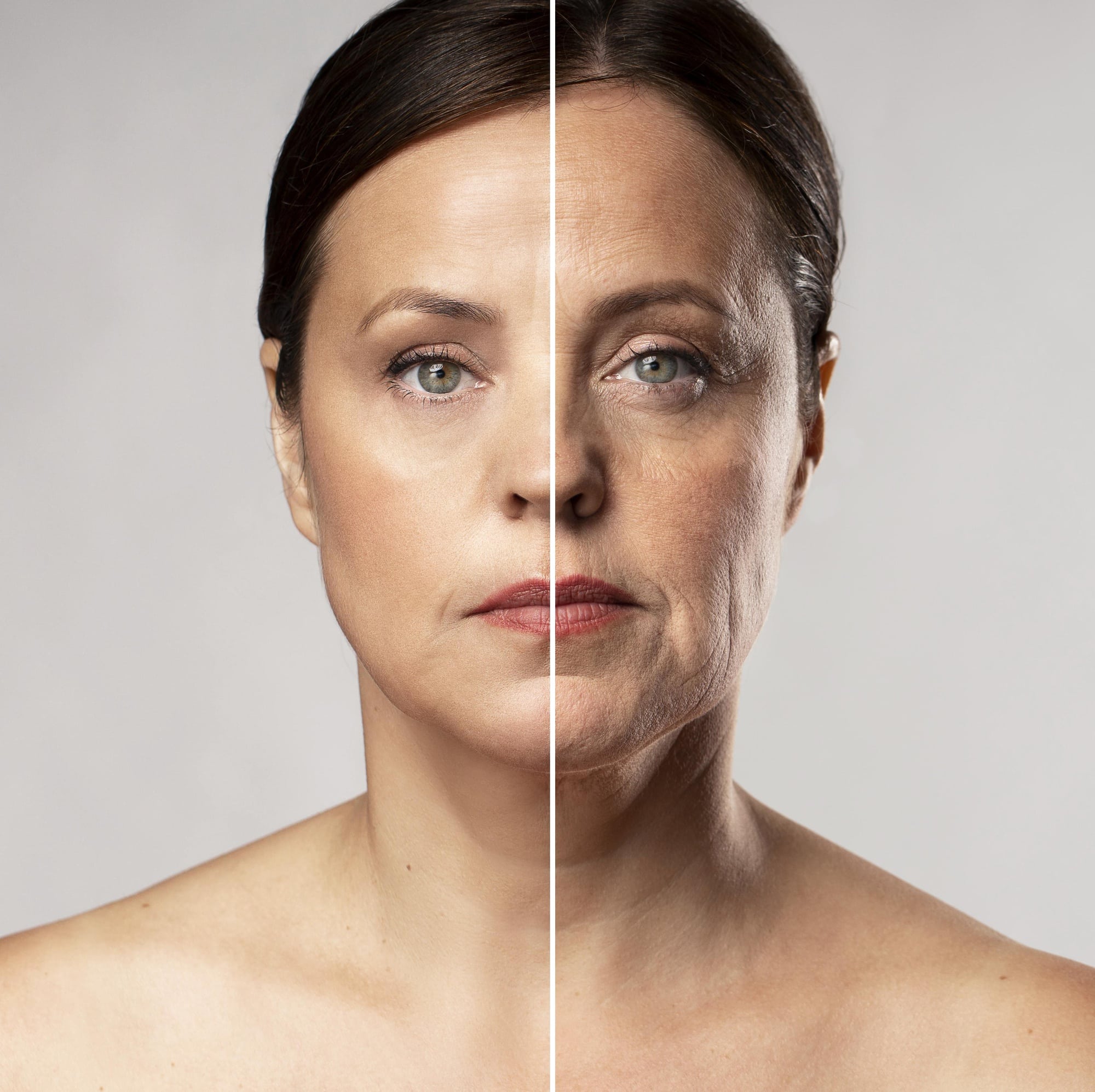 before-after filler