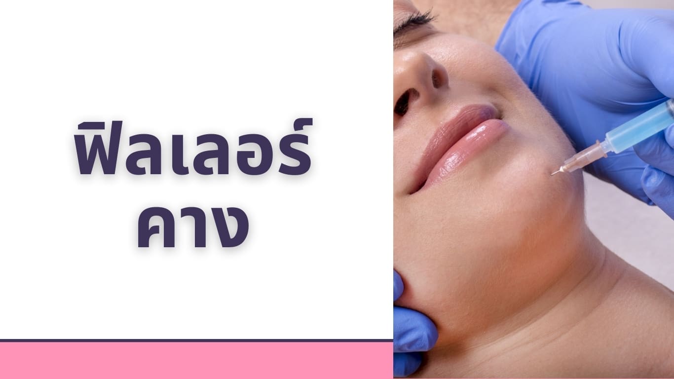 ฟิลเลอร์คาง