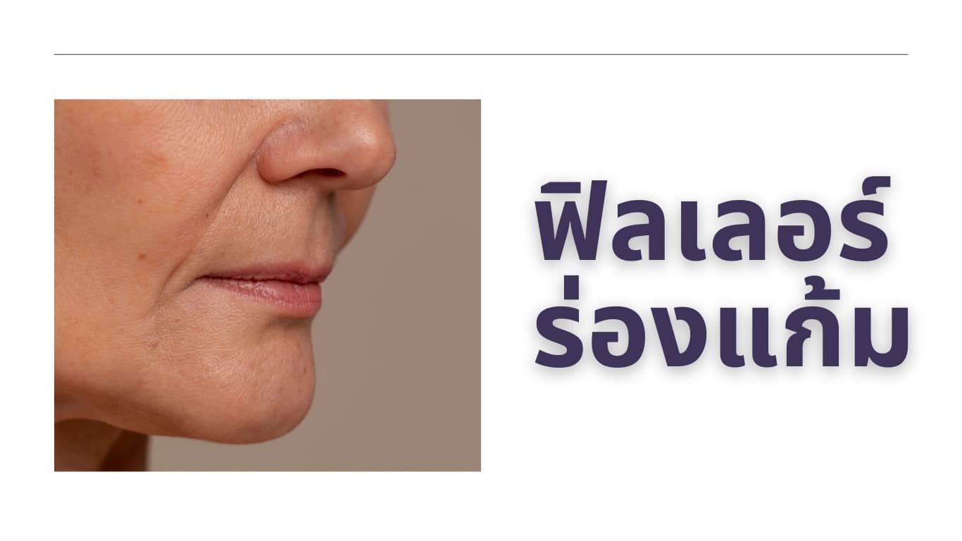 ฟิลเลอร์ร่องแก้มวันดีคลินิก