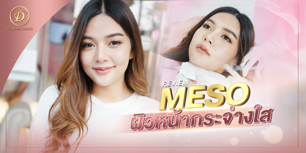 รีวิว Meso หน้าใส คุณเนอส ผิวหน้ากระจ่างใส วิ้งค์ไวท์มีออร่า
